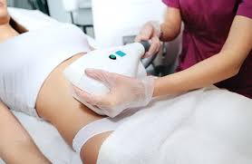 CoolSculpting for Fat Reduction: Safe Alternatives to Traditional Procedures